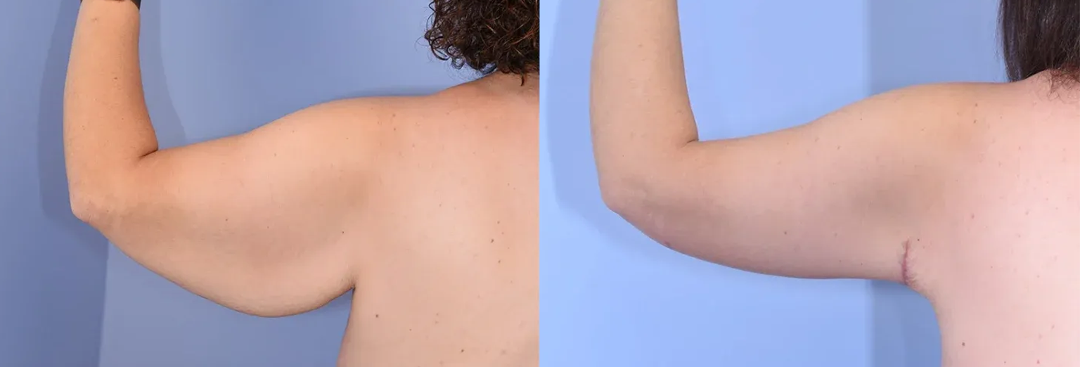 imgi_9_preop0061915-2-1536×552.webp copy