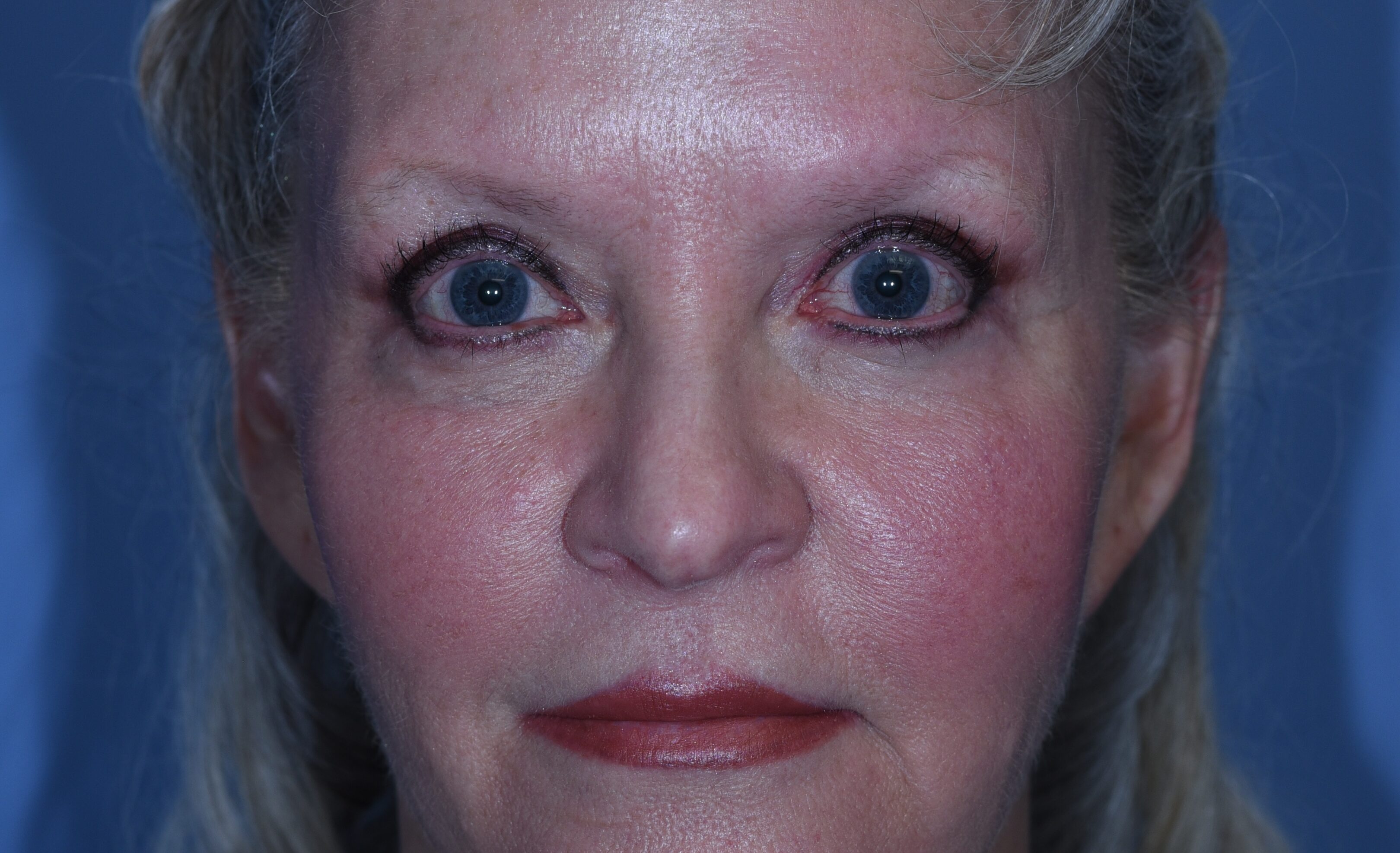 postop-20190304 copy