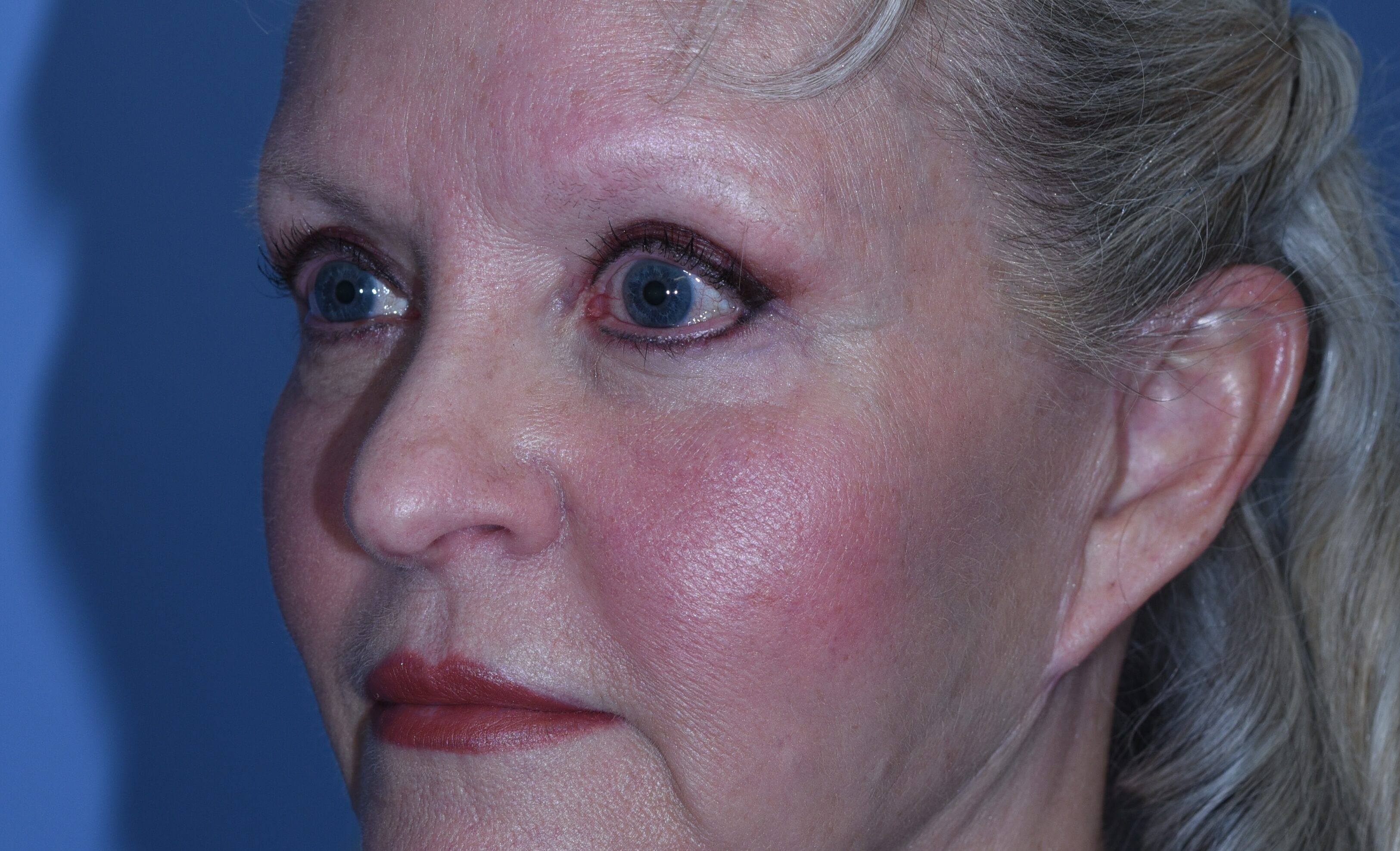 postop-20190304(2) copy