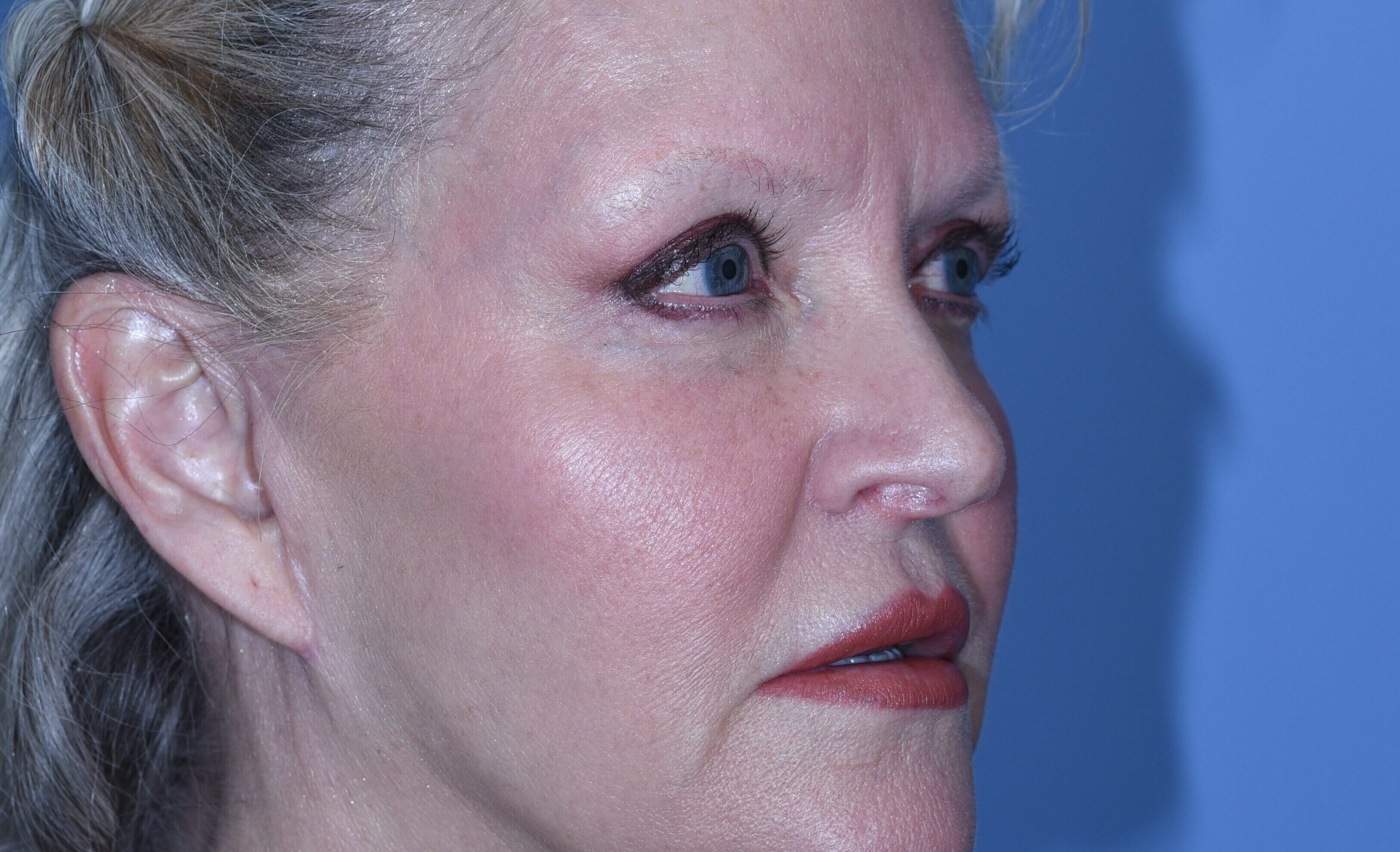 postop-20190304(3) copy