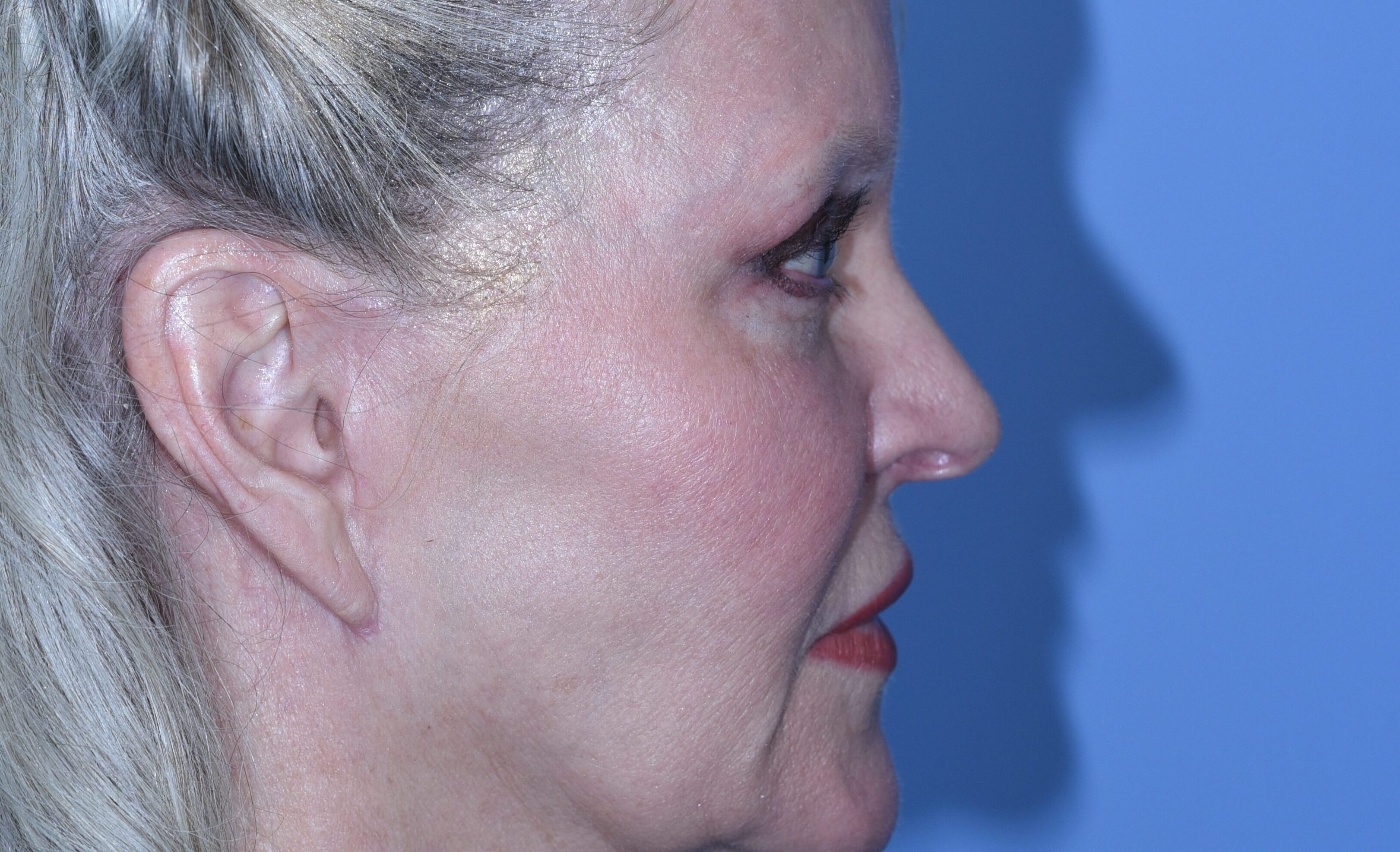 postop-20190304(4) copy