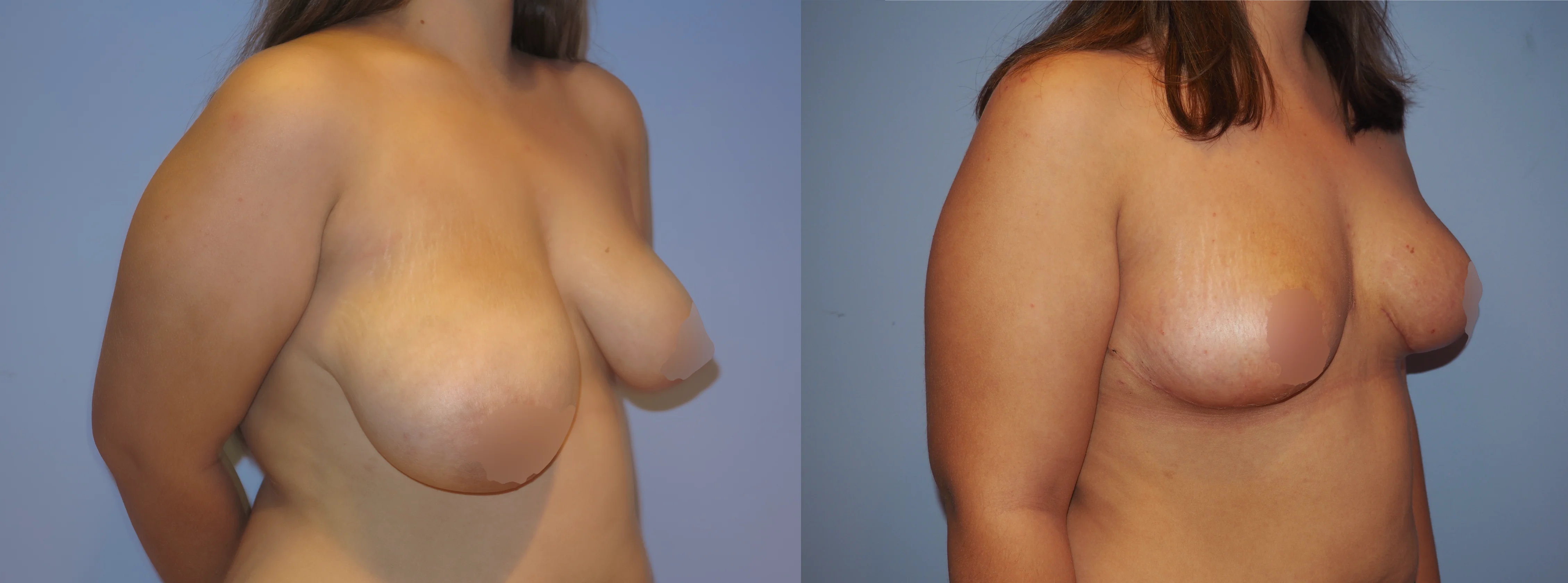 pexy2-2