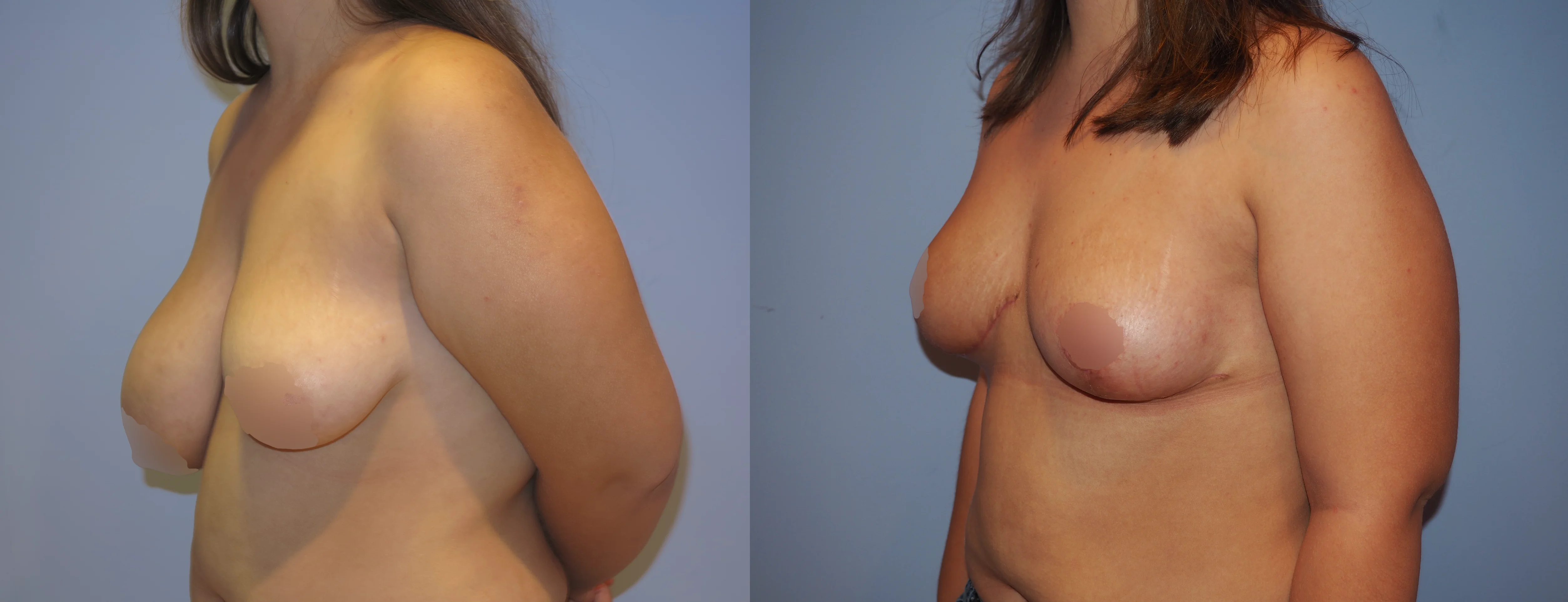 pexy2-3